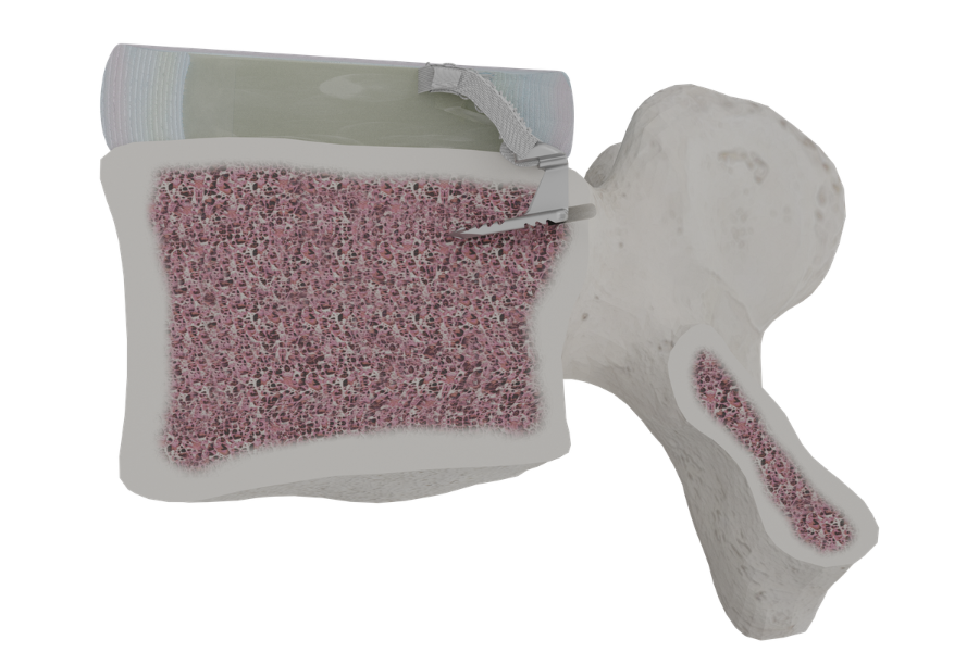 HowtheBarricaidImpla...